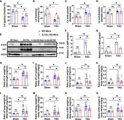 IL-12α deficiency attenuates pressure overload-induced cardiac inflammation, hypertrophy, dysfunction, and heart failure progression